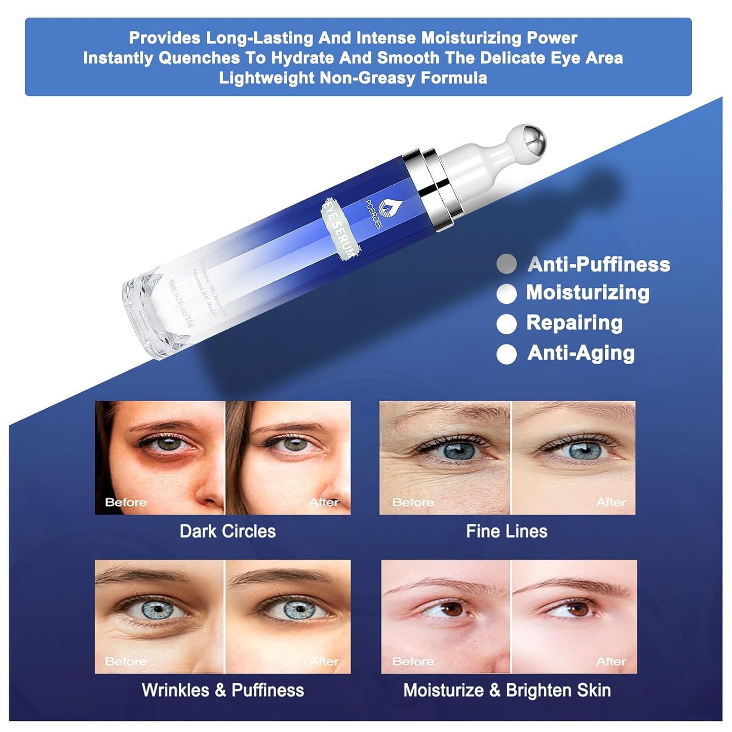 Eye Serum with 8% Caffeine 8% Retinol Hyaluronic Acid Niacinamide Peptides for Puffy Bags Fine Lines Dark Circles Wrinkles, under Eye Cream with 360° Roller Massage Ball, 0.5 Fl. Oz